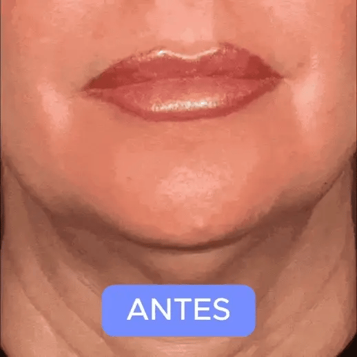 Encabezado