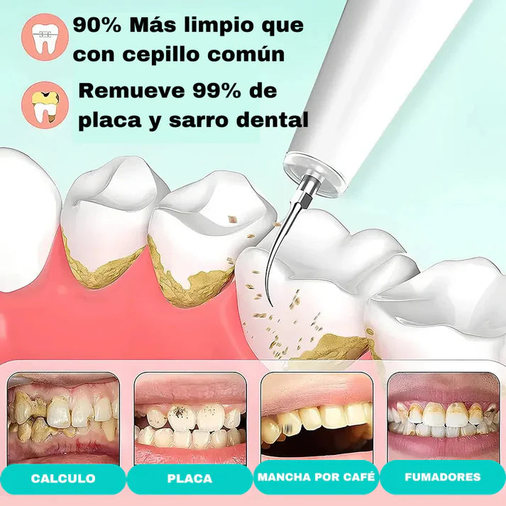 SUPER COMBO || IRRIGADOR + QUITA SARRO DENTAL