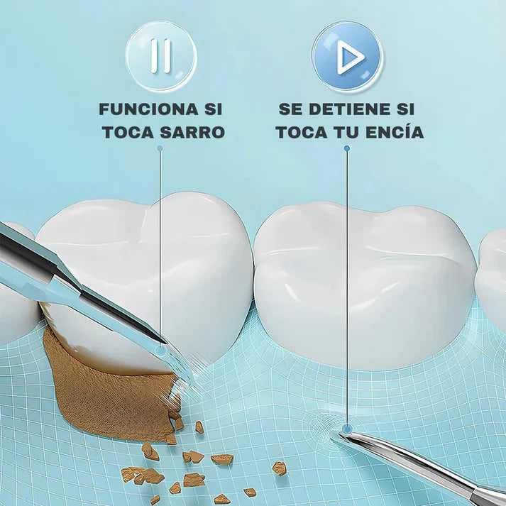 SUPER COMBO || IRRIGADOR + QUITA SARRO DENTAL