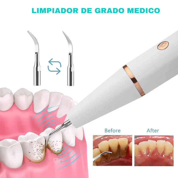 SUPER COMBO || IRRIGADOR + QUITA SARRO DENTAL