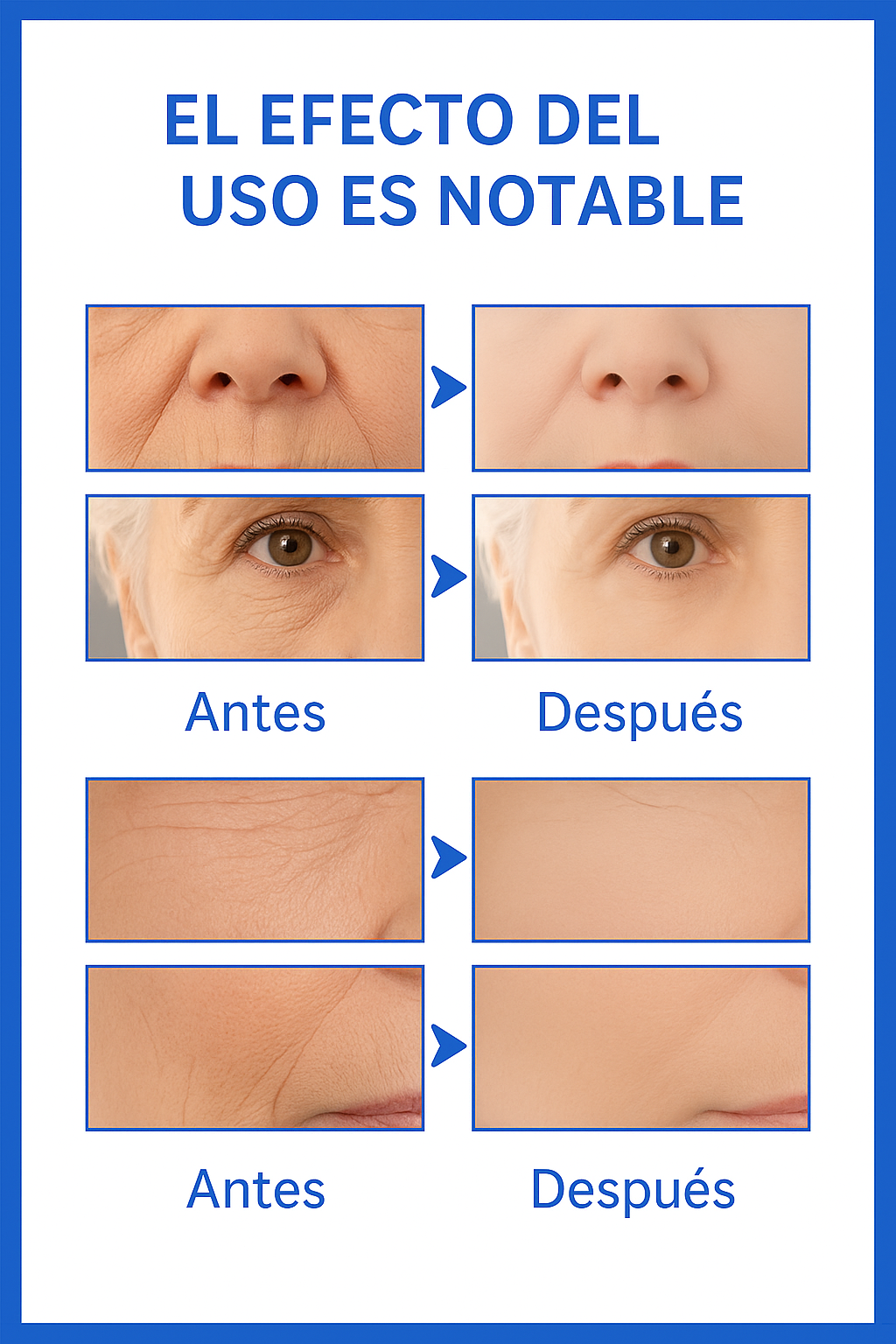 Botox Stock Solution || Suero Reafirmante Antiarrugas